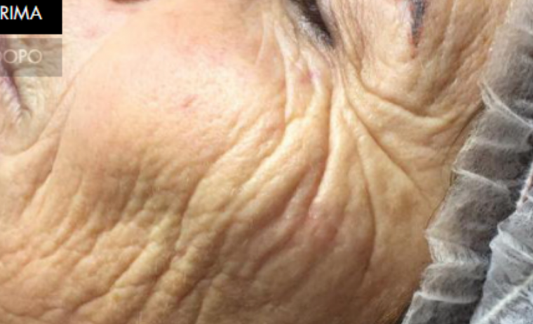 trattamento viso antiaging rhea bolzano