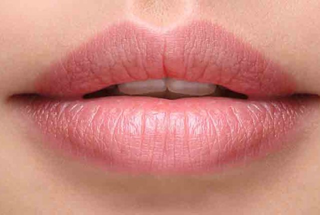 Filler Lippen MES